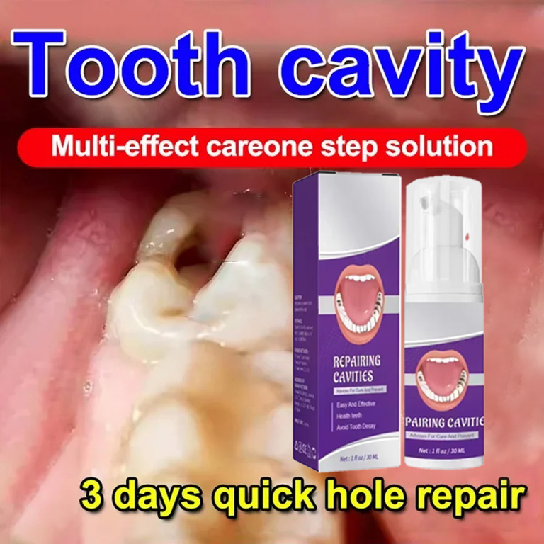 Teeth Whitening Cream - 歯のクリーニング用歯磨き粉は、歯の汚れを除去し、歯を白くし、虫歯を修復し、歯石や歯垢を除去し、歯周病や虫歯を予防します。