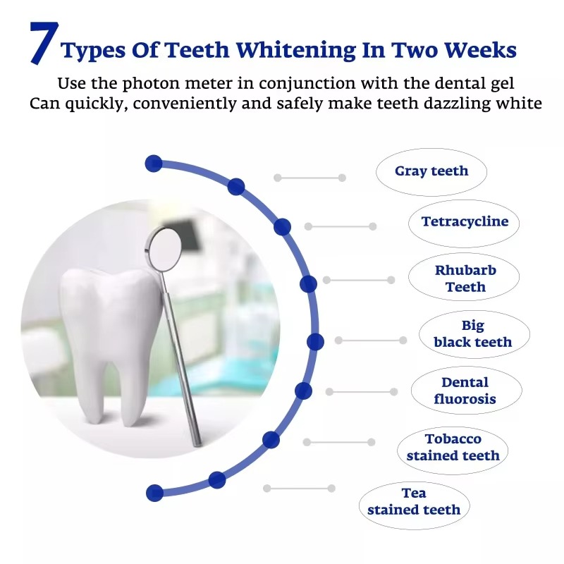 インテリジェントLEDブルーライトポータブルUSB/iPho - Teeth Whitening Device のレビューと価格
