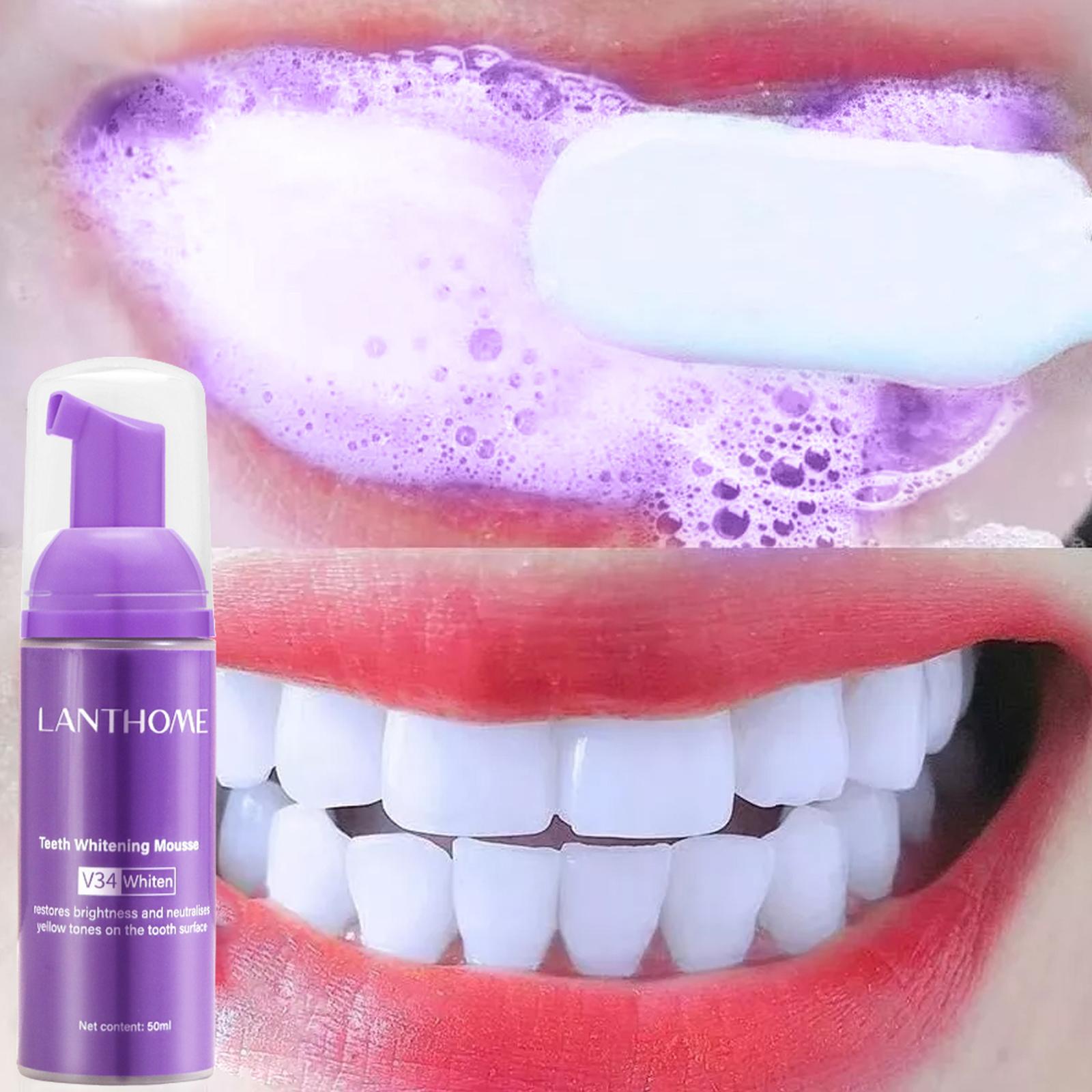 V34 ムース歯クリーニング歯磨き粉効果的な美白歯の除去深い - Teeth Whitening Yellow Teeth のレビューと価格