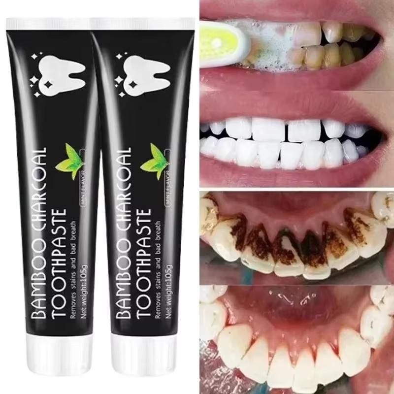 ホワイトニング歯磨き粉 竹炭歯磨き粉 口臭を吸収し、黄色い歯 - Teeth Whitening Yellow Teeth のレビューと価格