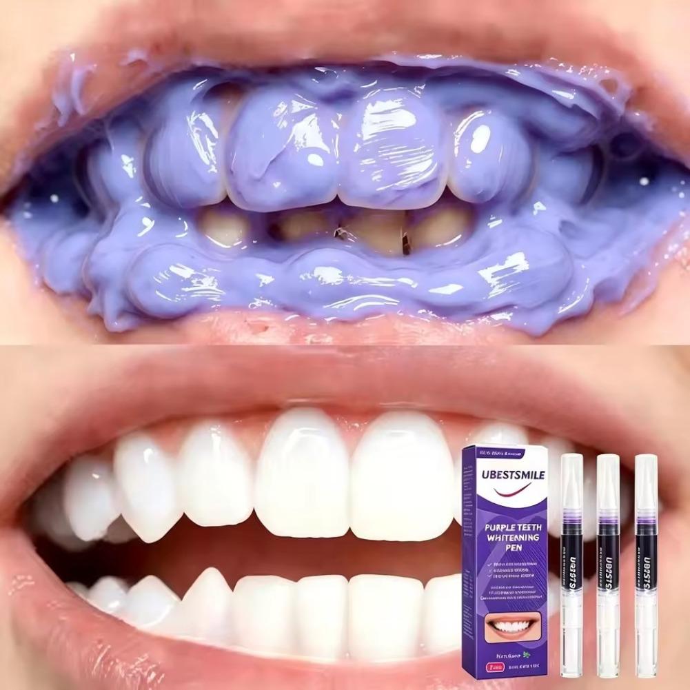 パープル歯のホワイトニングペンV34、PAPカラーコレクター - Teeth Whitening Pen のレビューと価格