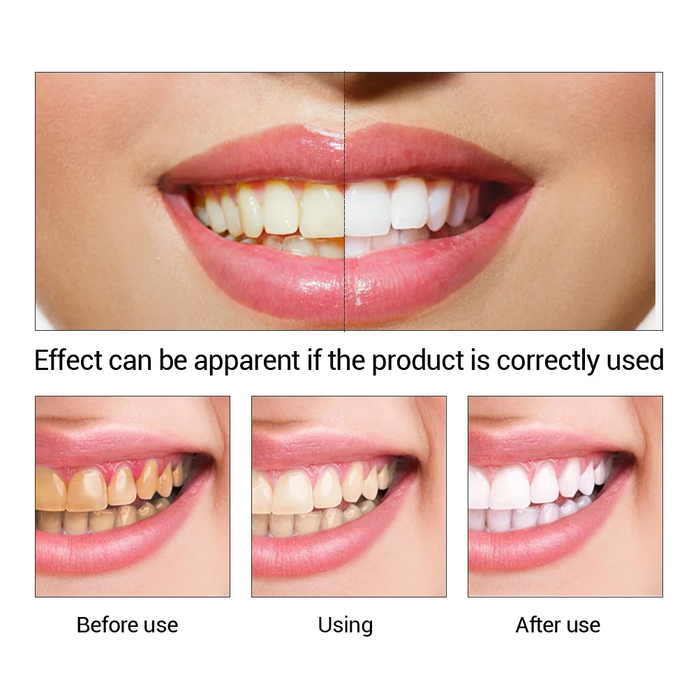 歯のホワイトニングエッセンス,口腔衛生,歯のホワイトニング, - Teeth Whitening Cream のレビューと価格