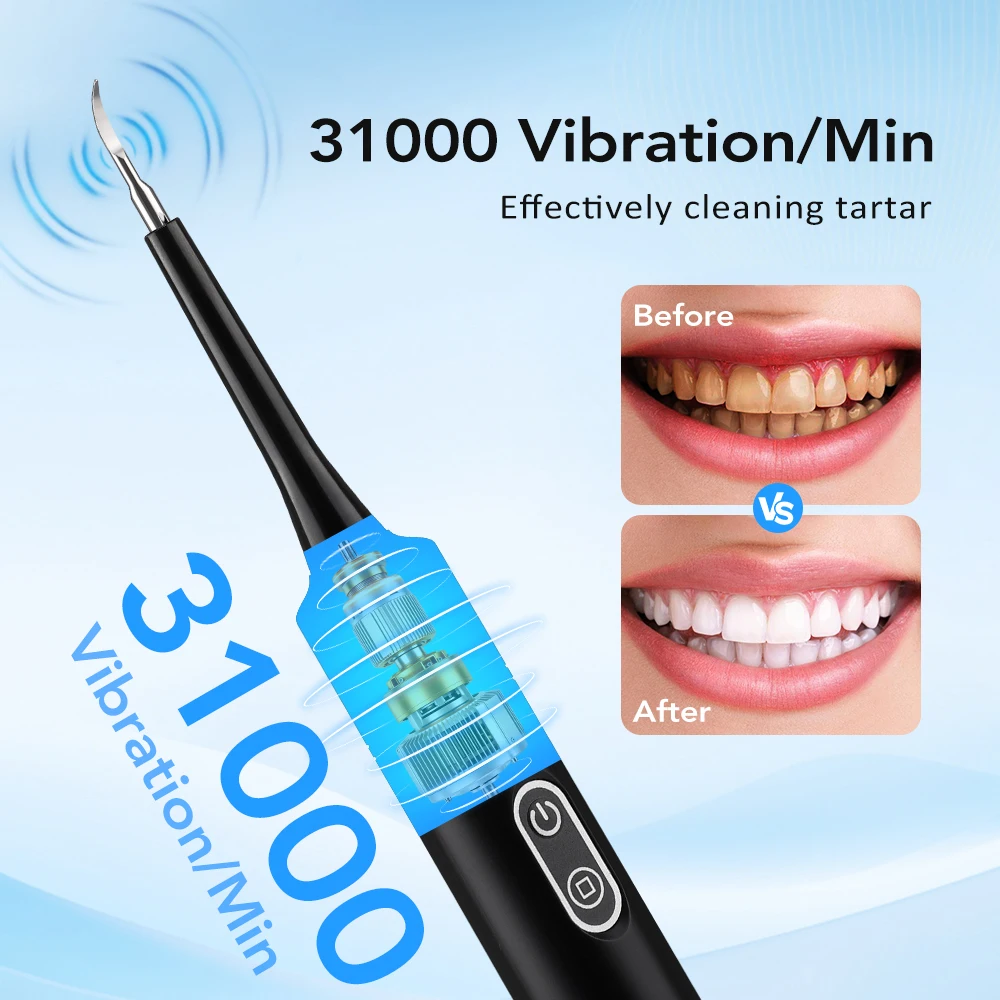 電気音波振動歯科用スケーラー歯のホワイトニング歯垢除去コーヒ - Teeth Whitening Home のレビューと価格